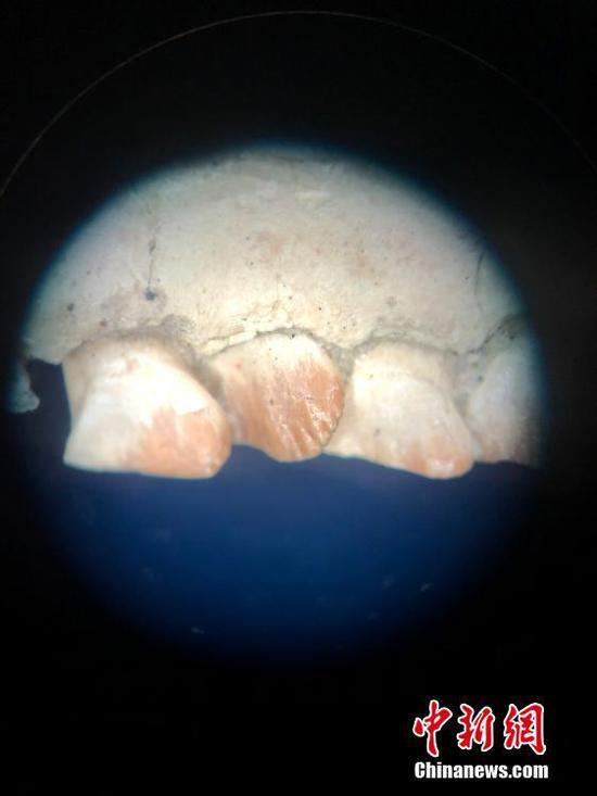图为显微镜下的长春龙上颌骨和牙齿。中新社记者 张瑶 摄